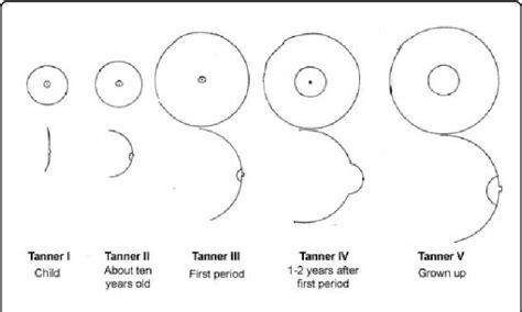 teen puffy nipples|Breast development: Stages and how to spot growth signs .